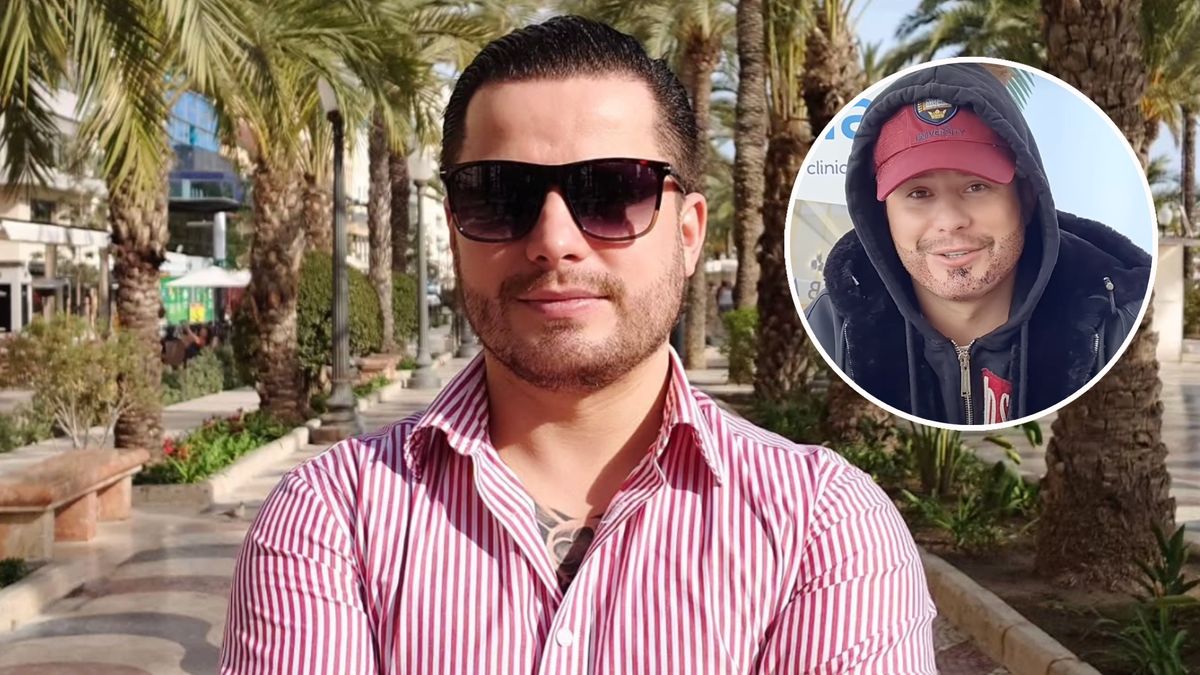 Rafał Collins miał przeszczep włosów na brodzie