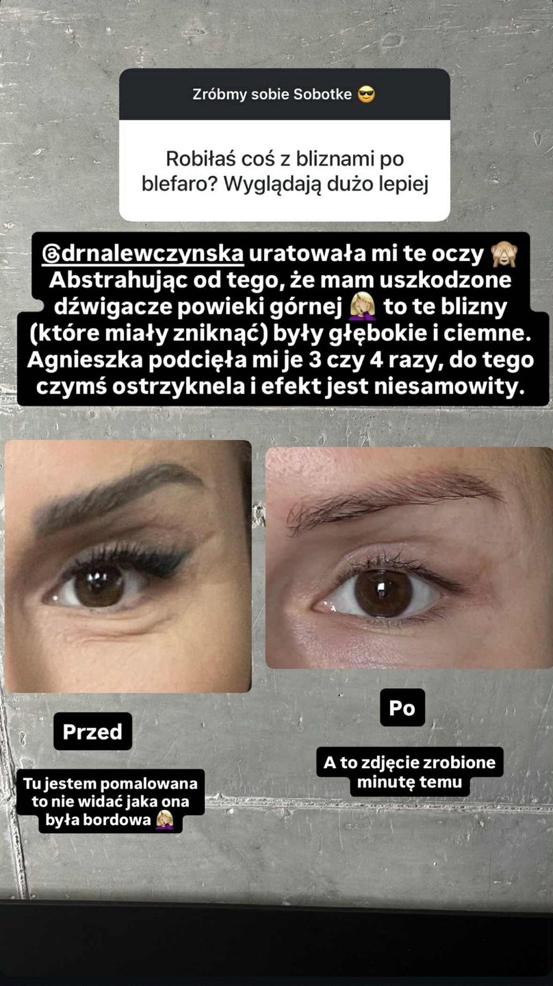 Blanka Lipińska