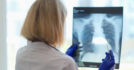Pięciolatek cierpiał na uciążliwy kaszel. Prześwietlenie płuc zszokowało lekarzy