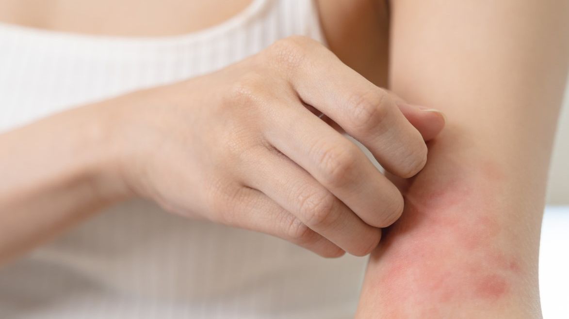 Prometazyna to środek stosowany w leczeniu objawów związanych ze stanami alergicznymi skóry i górnych dróg oddechowych.