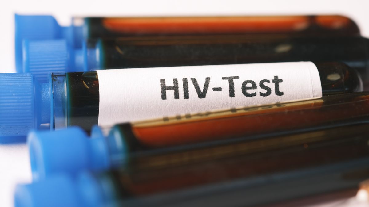 Coraz więcej osób dowiaduje się o pozytywnym wyniku testu na HIV