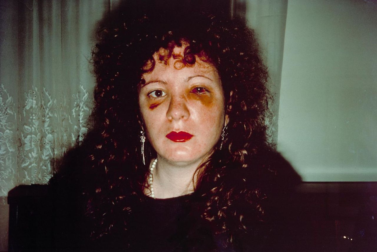 Autoportret ofiary przemocy domowej: Historia zdjęcia Nan Goldin