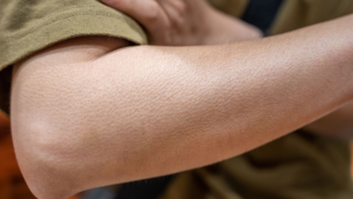 Close up of woman arm with goosebumps on her skin.Boy_Anupong