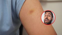 Takie znaki na skórze mogą wskazywać na nowotwór. "Nie powinny być ignorowane"