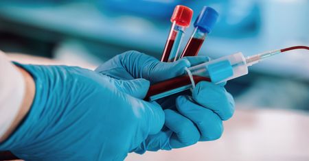 Antygen SCC w diagnostyce i monitorowaniu raka płaskonabłonkowego