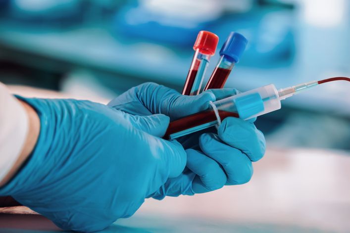 Antygen SCC wykorzystywany jest w diagnostyce raka szyjki macicy
