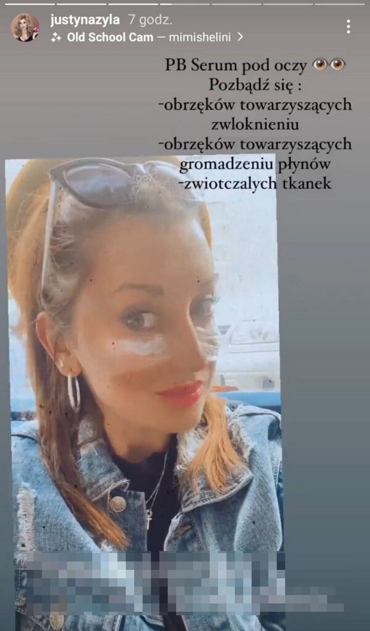 Justyna Żyła relacjonuje pobyt w gabinecie medycyny estetycznej