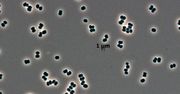 Ta bakteria "udaje martwą". NASA przypadkiem wysłała ją na Marsa