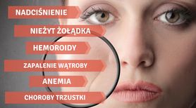 5 niedoborów witamin wypisanych na twarzy