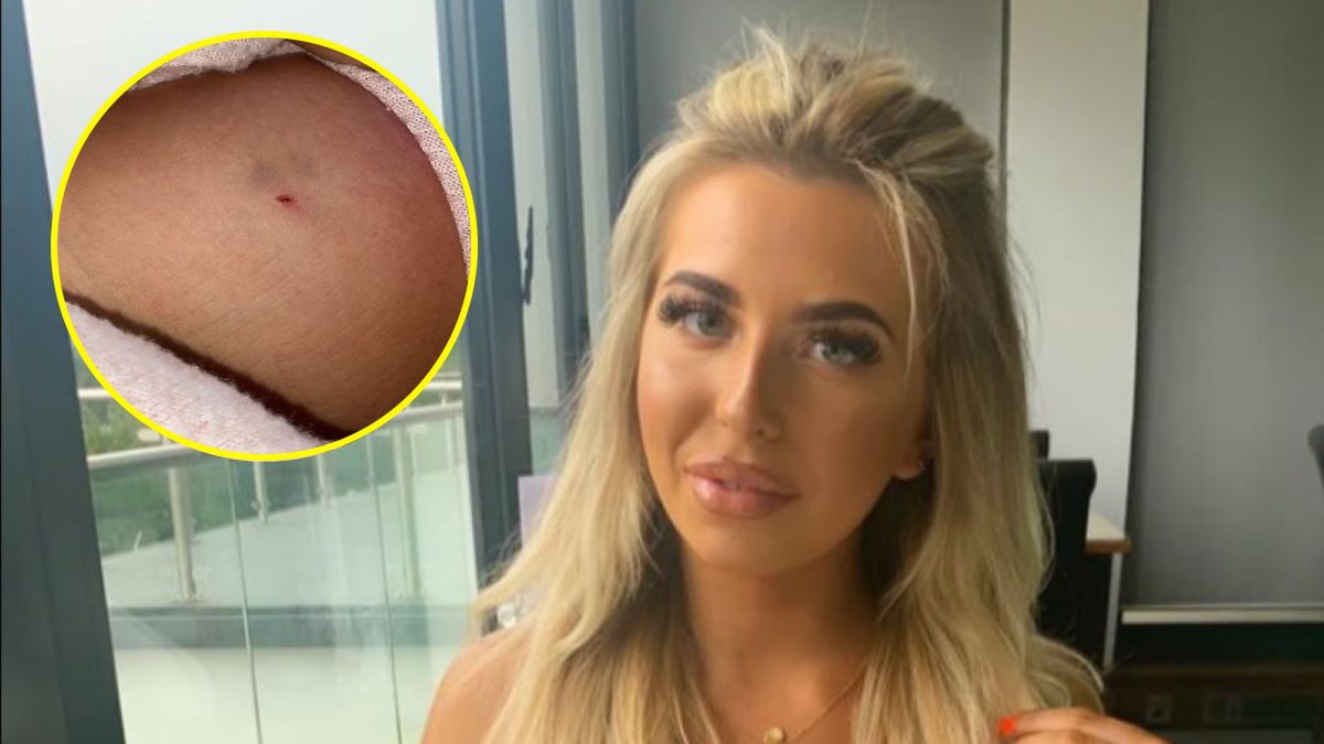 19-latka twierdzi, że ktoś wstrzyknął jej coś na jarmarku bożonarodzeniowym 