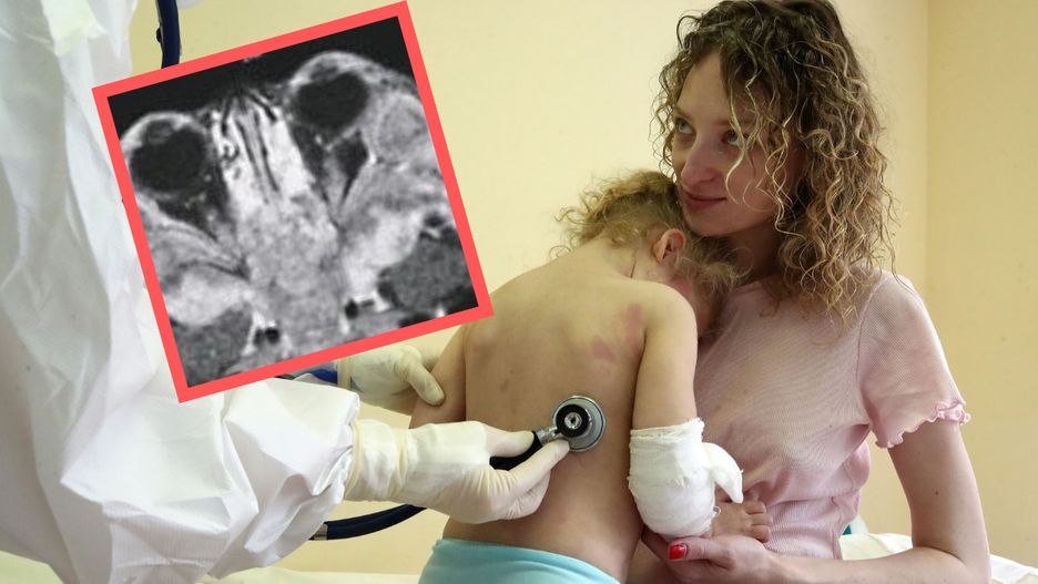 Objaw groźnego nowotworu