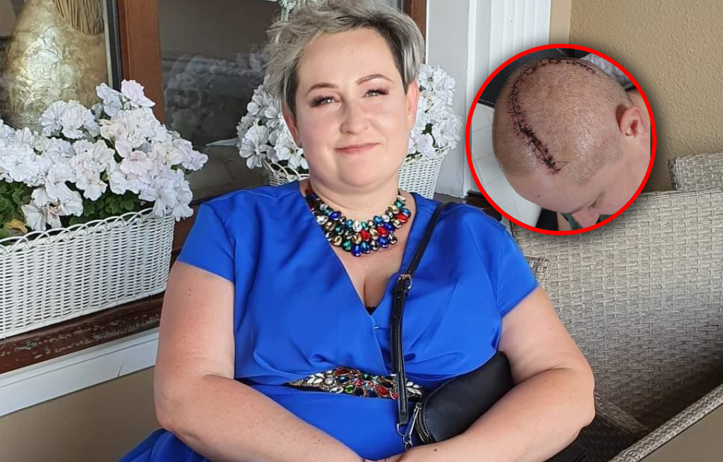 Drętwiała jej lewa ręka. Dziś wie, że był to objaw nowotworu