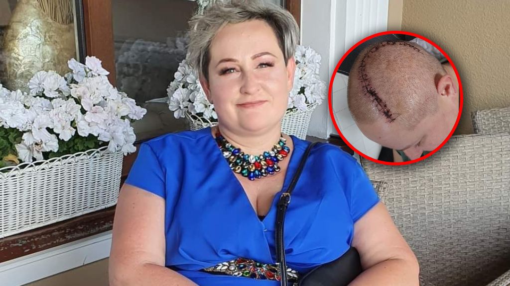 "Czułam ból na środku głowy, jakby ktoś na nią naciskał. Piekło tak, jakby ktoś mi w głowie rozpalił ognisko"