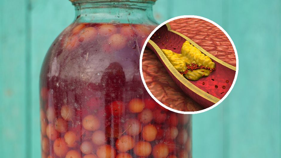 Jakie właściwości ma agrestówka?