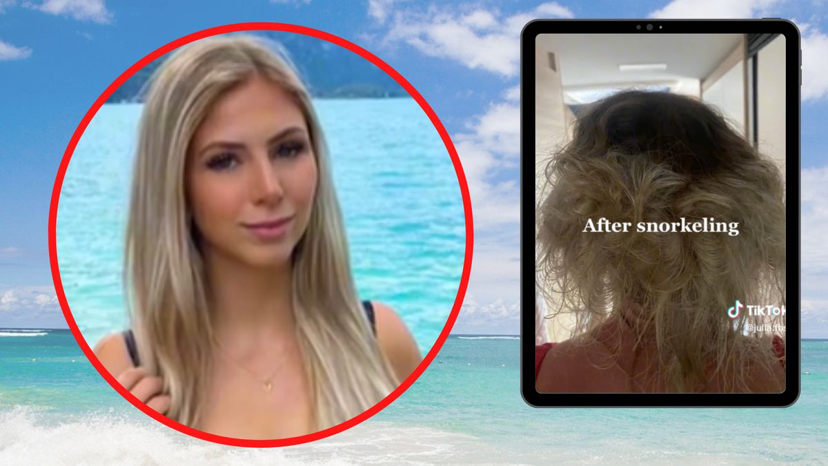 Koszmar po nurkowaniu. To zostało z jej doczepów.