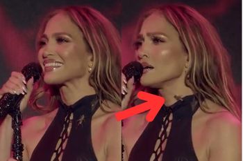 Spójrzcie na szyję Jennifer Lopez. To przeszkodziło jej podczas koncertu