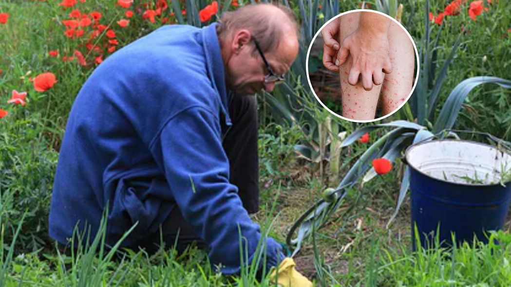 Wystarczy niewinne ukłucie kolcem róży. Teraz jest wysyp takich przypadków