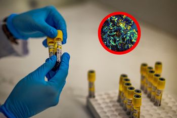 Przełom w medycynie? Mówią o sukcesie u pacjenta z HIV