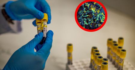 Przełom w medycynie? Mówią o sukcesie u pacjenta z HIV