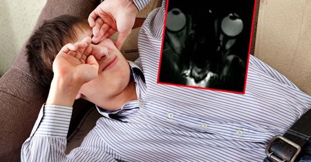 Pocierasz oczy? Skutki mogą być fatalne
