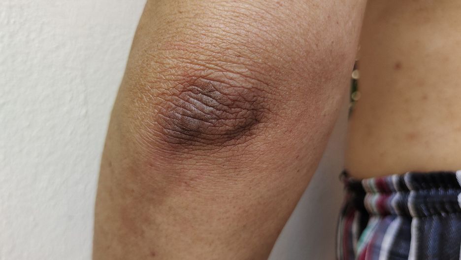 Black elbow.