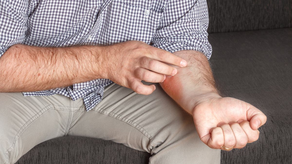 Chora wątroba może dawać nietypowe objawy