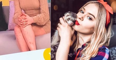 Julka Wróblewska pokazała pogryzione nogi w "Dzień Dobry TVN". Fretka Luna daje jej popalić? (FOTO)