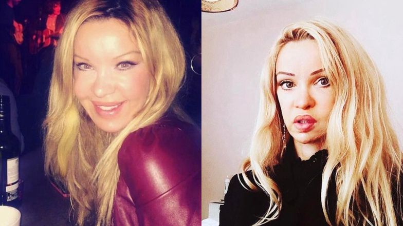 Te gwiazdy pożałowały operacji plastycznych