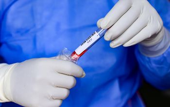 To "cudowny lek". Polscy naukowcy przed nim przestrzegają