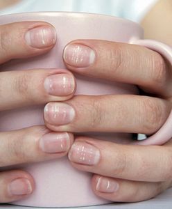 Białe plamy na paznokciach. Co oznaczają i jak się ich pozbyć?