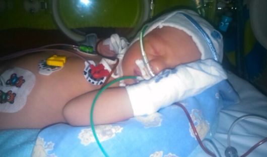 Filipek ma złożoną wadę serca