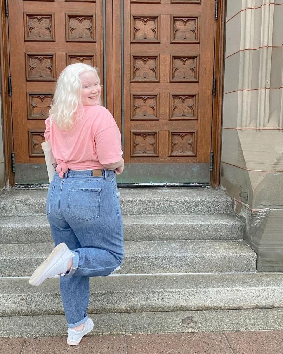 Oceanne cierpi na albinizm. W mediach społecznościowych dzieli się z internautami swoją codziennością