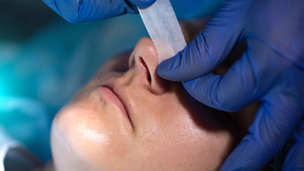 Operacja przegrody nosowej to jeden z najczęściej wykonywanych zabiegów laryngologicznych