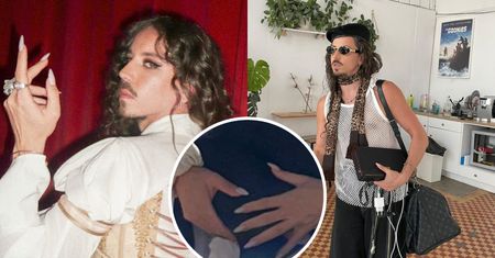 Michał Szpak konkretnie się ZAPUŚCIŁ? Ekspertka dała jasny komentarz w sprawie jego paznokci