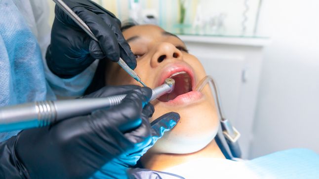 Bonding zębów staje się coraz popularniejszym zabiegiem, który jest dobrą alternatywą dla licówek.