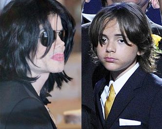 Prince odziedziczył po Michaelu... bielactwo?!