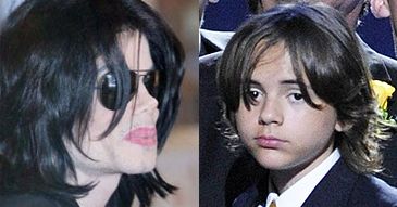 Prince odziedziczył po Michaelu... bielactwo?!