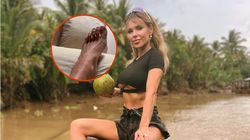 Doda obudziła się z pogryzionymi nogami. "Delikwent po prostu zdechł po tym obiedzie"