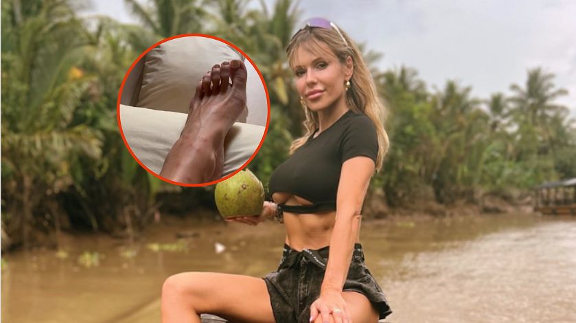 Doda obudziła się z pogryzionymi nogami. To były pluskwy