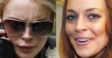 Lindsay Lohan ma nowe usta?!