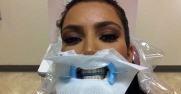 Kim Kardashian u dentysty!
