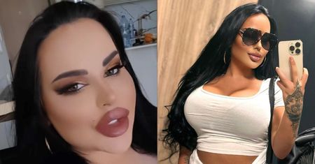Esmeralda Godlewska powiększyła piersi w Turcji. Jest załamana: "Rany i blizny wyglądają, jakby ZROBIŁ JE RZEŹNIK!"