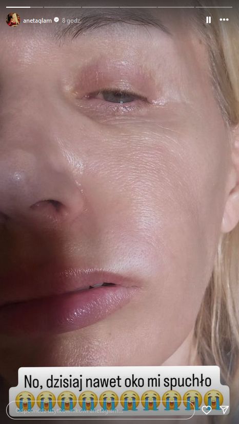 Aneta Glam podzieliła się swoim wakacyjnym dramatem