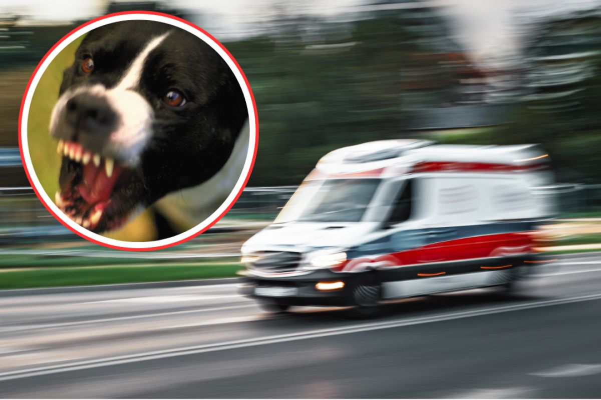 Pies rzucił się na 4-latka. Chłopiec trafił do szpitala