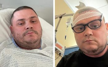 Kucharz z "MasterChefa" walczy z guzem mózgu. "Nie poddam się"