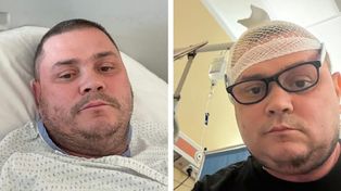 Kucharz z "MasterChefa" walczy z guzem mózgu. "Nie poddam się"