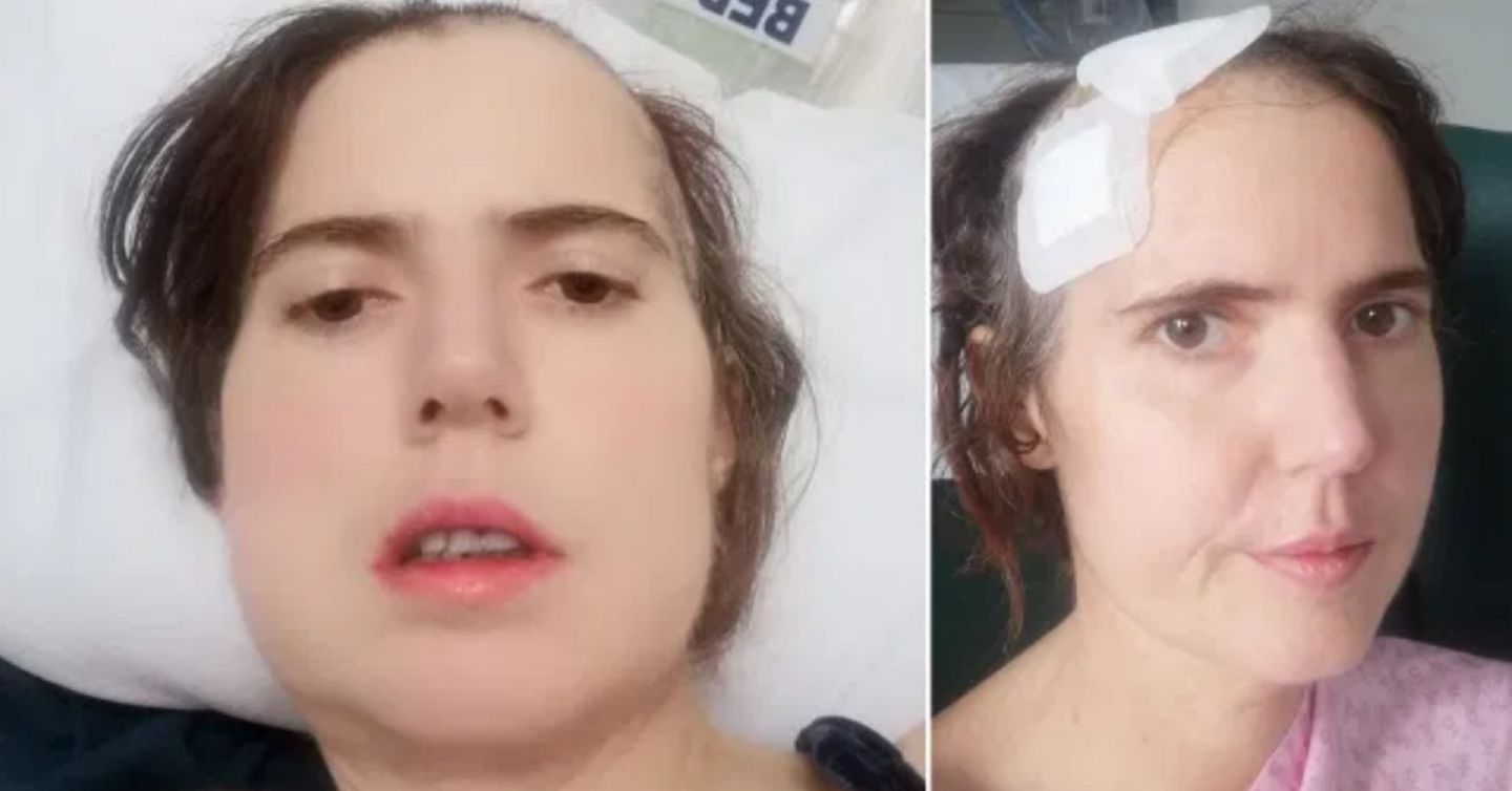 Rebecca będzie miała problemy z samodzielnym funkcjonowaniem do końca życia (Facebook)