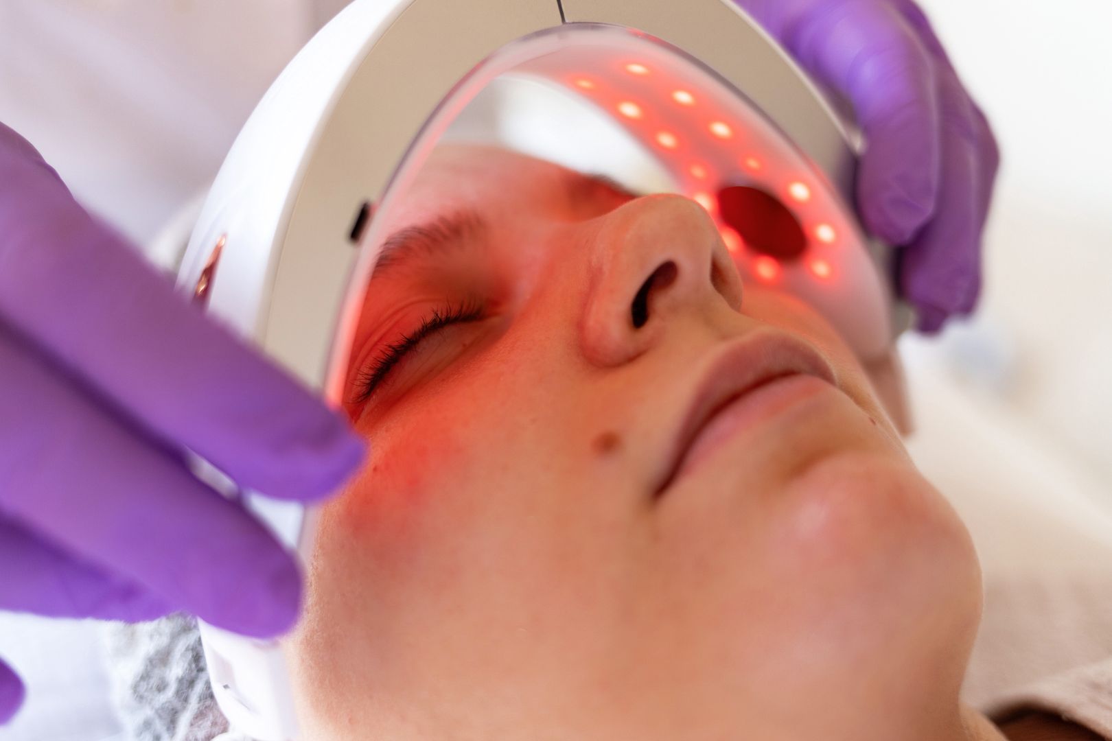 The cosmetologist's hands in medical gloves place a LED lamp with red light over the patient's face.
Tatiana Cheremukhina