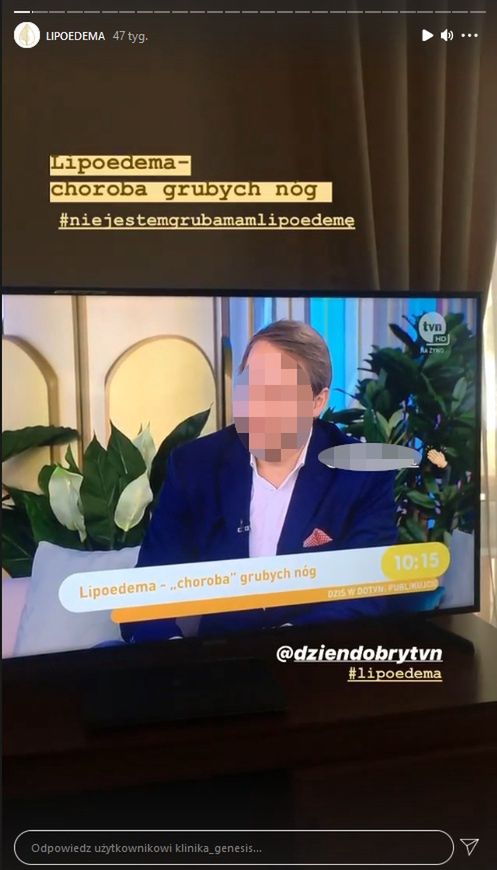 Doktor J. był swego czasu gościem "Dzień Dobry TVN". Lekarz był wtedy przedstawiony jako ekspert od usuwania skutków lipoedemii
