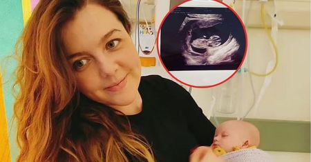 Radzili jej aborcję. Urodziła córeczkę z zespołem Downa